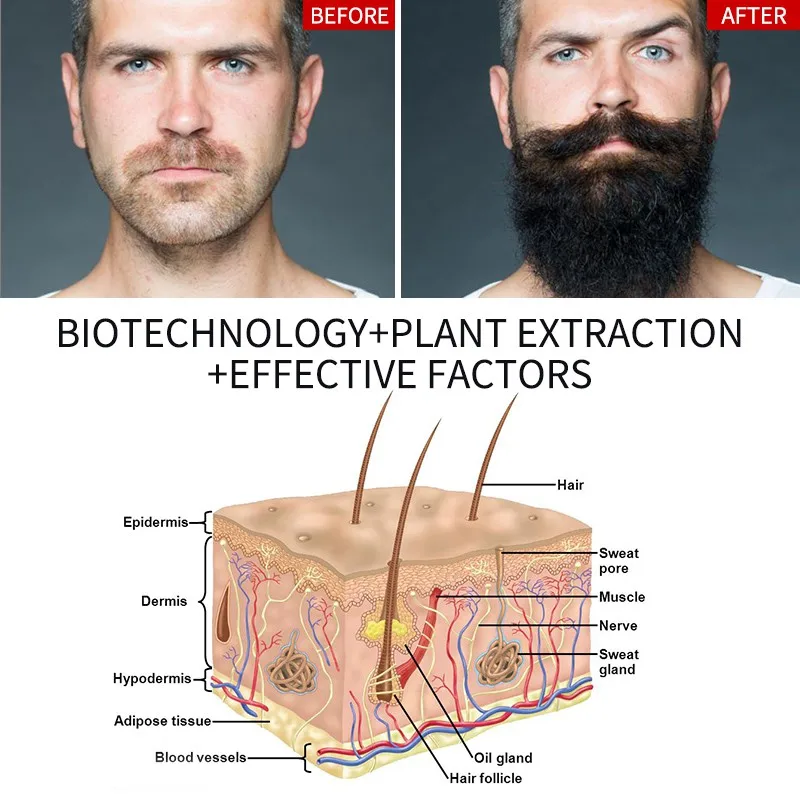 For Men Beard Growth Oil Grow Beard Thicker Full Thicken Hair Oil Hair Spray Laser Growth Ginseng
