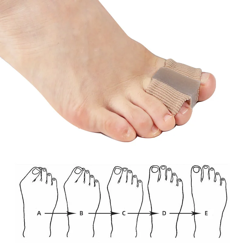 1PCS Silicone Toe Spreader Finger Separator Valgus Corrector Thumb Correction Straightener Foot Care Orthopedic toe spreader