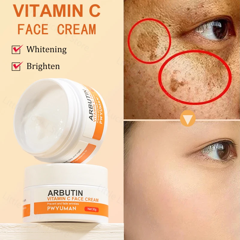 

Vitamin C Whitening Freckles Face Cream Remove Melasma Dark Spots Lighten Melanin Acne Scar Anti-aging Brighten Korean Skin Care