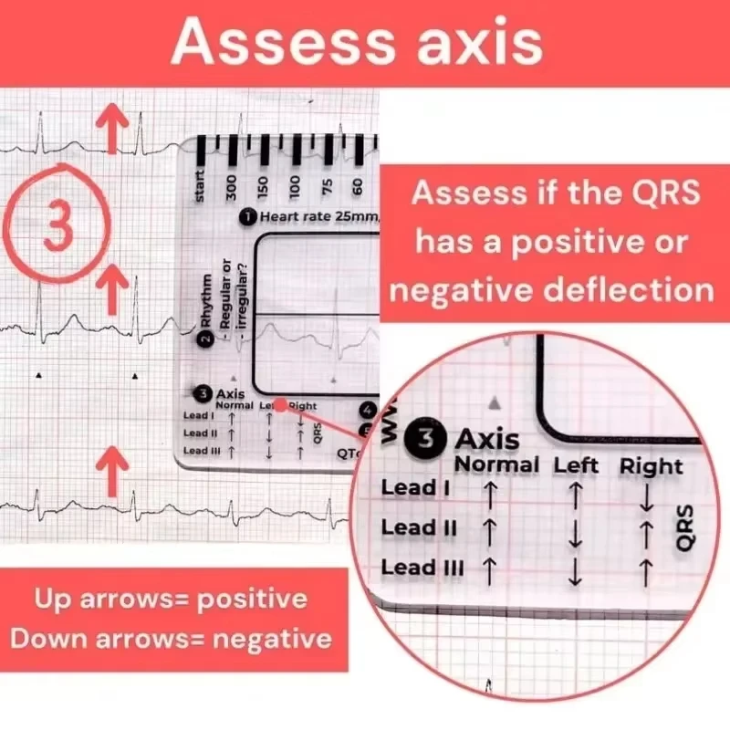 Ecg 7 Step Ruler 7 Step Scale for Ecg Observation Portable Transparent 7step Ruler Measurement Tool for Interpretation measurement tool