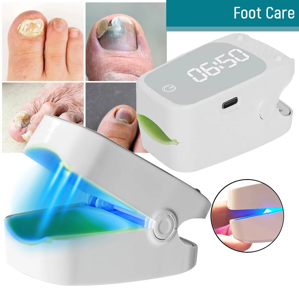 905NM Nail Fungus Laser Nail Treatments Device Light Therapy USB Charging for Fingernails and Toenails Onychomycosis Cure Tools
