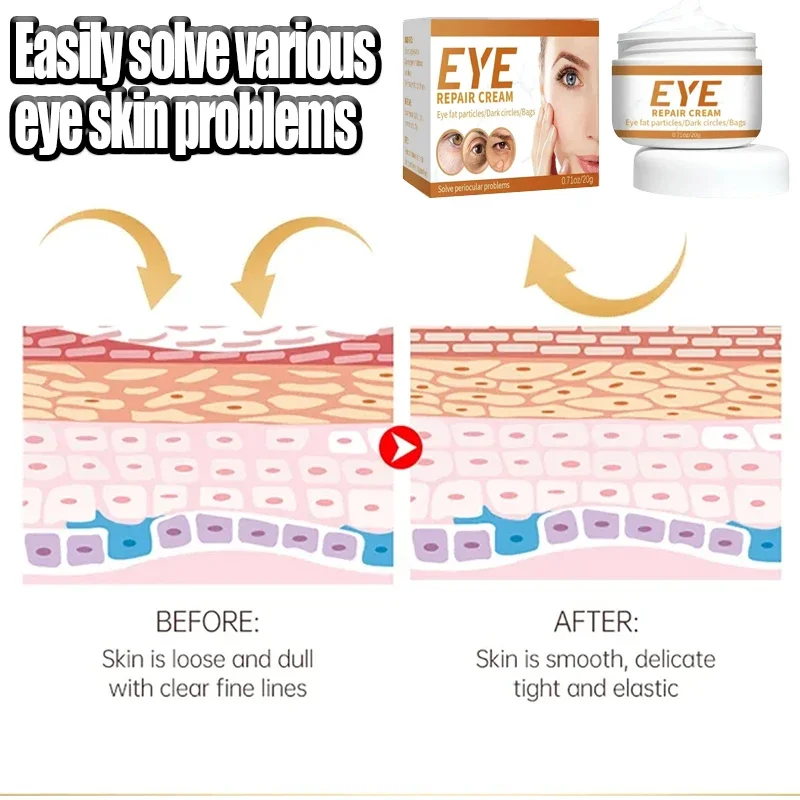 Eye Bags Remover Eye Cream Eye Problem Solver Instant Remove Wrinkle Eye Cream Eye Bags Dark Circles Anti Puffiness Firm Cream Under Eyes Lightening Fine Lines Moisturizing
