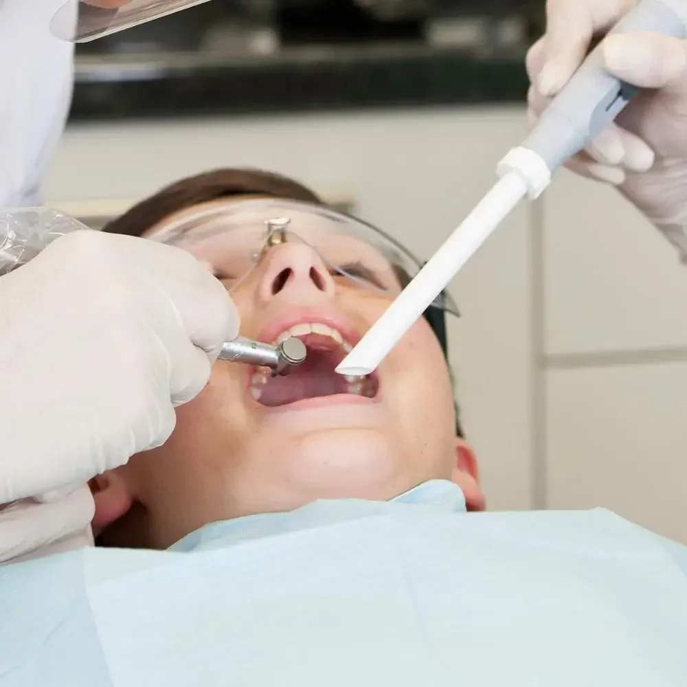 300 ชิ้นแบบใช้แล้วทิ้ง Hve ปริมาณสูงดูดระบายอากาศทิปการขนถ่ายทางทันตกรรมเครื่องมือทันตกรรมทันตกรรม 1