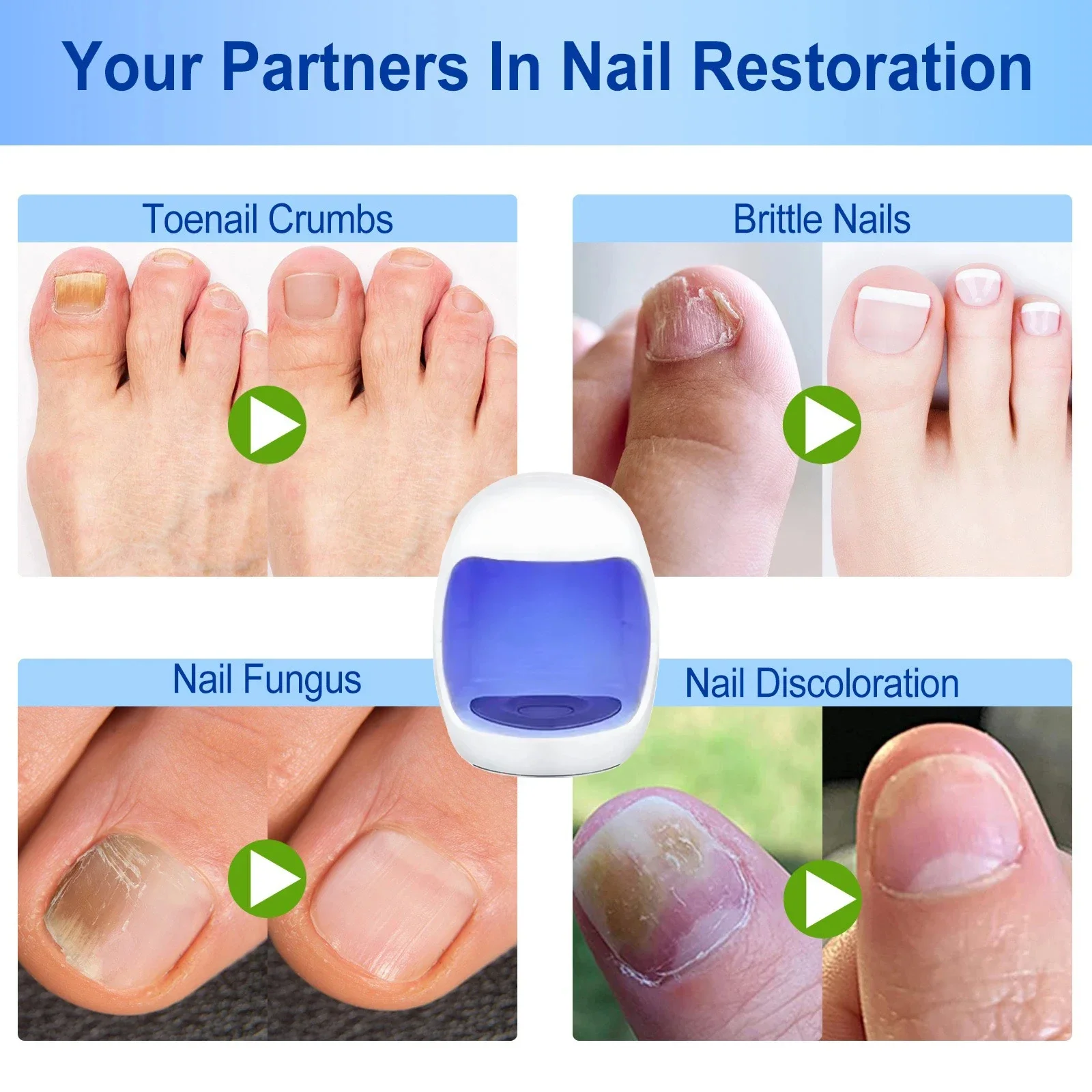 Nail Fungus Treatment Device Foot Toe Nails Fungal Repair Serum Anti Infection Gray Nails Onychomycosis Paronychia Remove Tools 3
