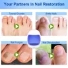 Nail Fungus Treatment Device Foot Toe Nails Fungal Repair Serum Anti Infection Gray Nails Onychomycosis Paronychia Remove Tools 3