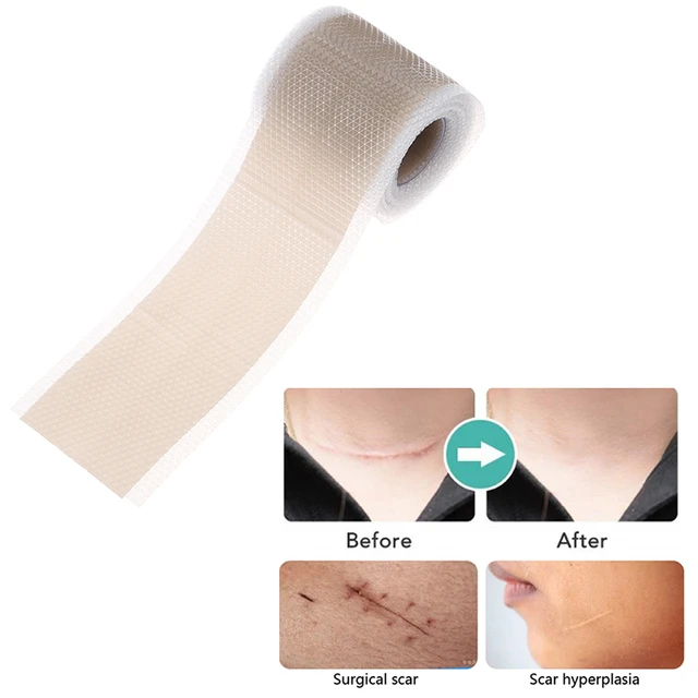 Silicone Scar Sheets(1.6”X120”Roll-3M)Silicone Scar Tape,Reusable Medical  Scar Removal ScarPatch for C-Section,Surgery,Burn,Acne