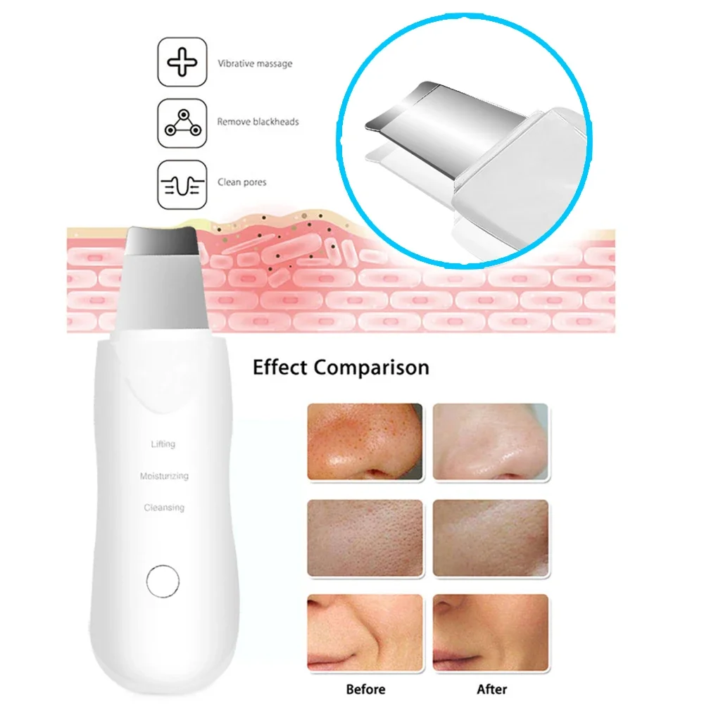 Ultrasonic Skin Scrubber Vibration Face Spatula Blackhead Remover Shovel Clean Cavitation Peeling Facial Lifting skin care