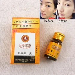 1 Pcs/2 Pcs/3 Pcs/5 Pcs New Natural Herbal Fragrance Mole Removal Moisturizing Whitening Liquid 5ml