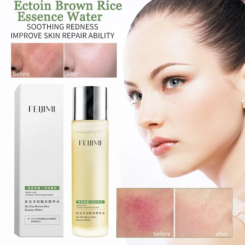 150ml-ectoin-brown-rice-essence-water-anti-redness-toner-for-spider-vein-removal-shrink-pore-moisturize-brighten-soothe-facecare