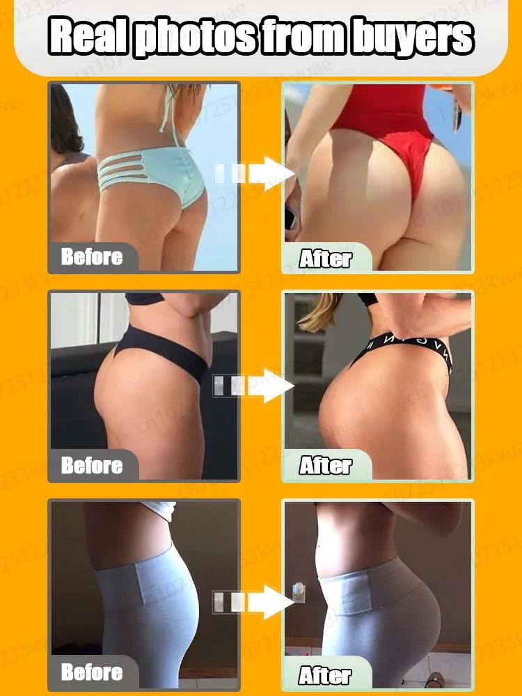 Lift and tighten the buttocks to create a perfect peach buttocks buttocks lift