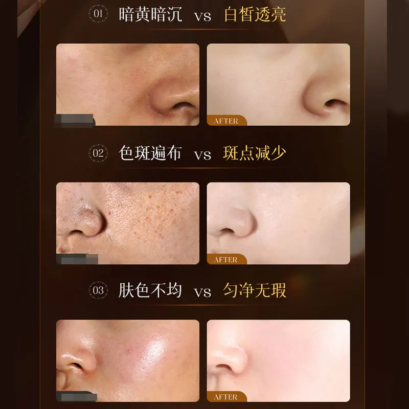 Genuine Men's Whitening and Anti-freckle Cream, Lightening Spots and Brightening Skin Tone, Men's Skin Care Products