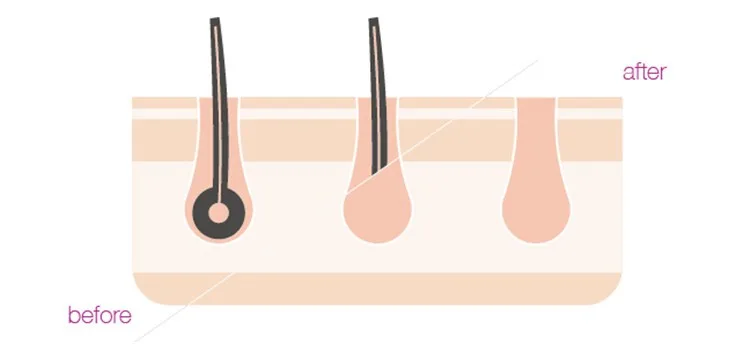 S47934140587a49f6a35fa74fa37950d5A