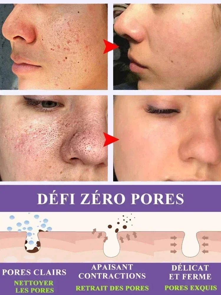 S&eacute;rum de r&eacute;paration de pores qui r&eacute;pare les pores poreux et opaques et restaure une peau parfaite.