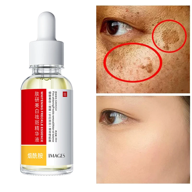 Dark Spot Corrector Whitening Serum Face Bleaching Serum Brighten Blemish Fade Freckles Chloasma Facial Essence Skin Care