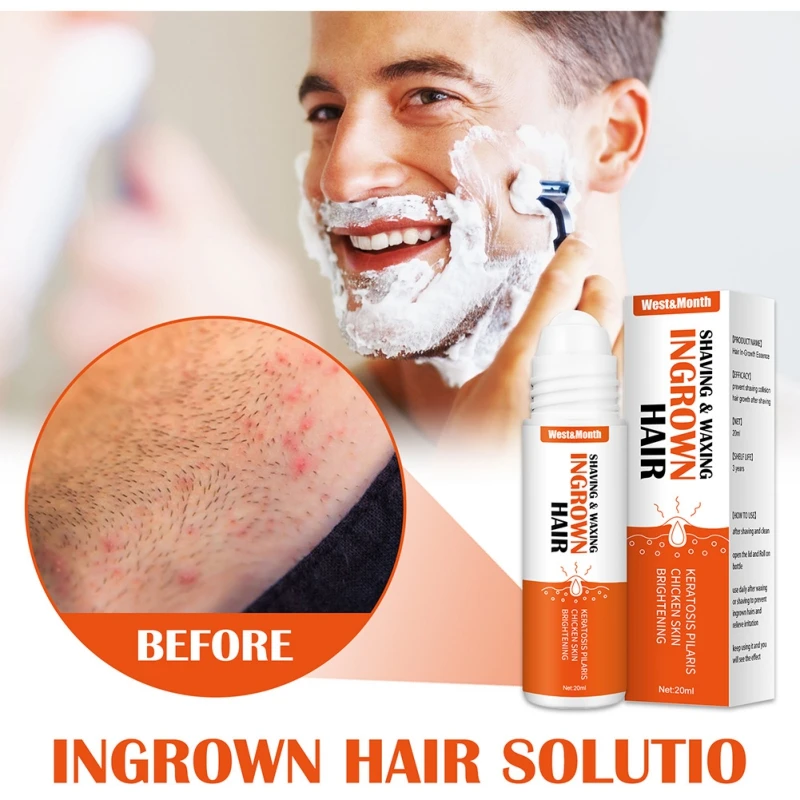 

20ml Ingrown Hair After Shave Repair Shaving Waxing Serum Treatment Prevent Razor Bumps Soothes Redness Soothes Skin Care Beauty