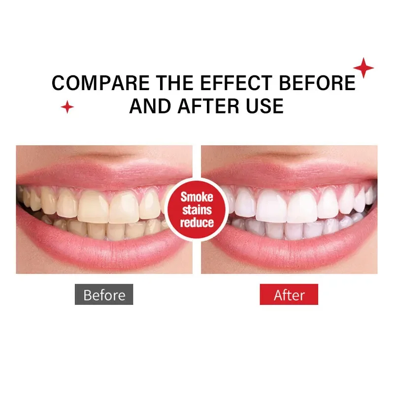 Probiotic Toothpaste 120g SP-6 Whitening Tooth Remove Plaque Stains Teeth Whitener Oral Hygiene Clean Fresh Breath Denta
