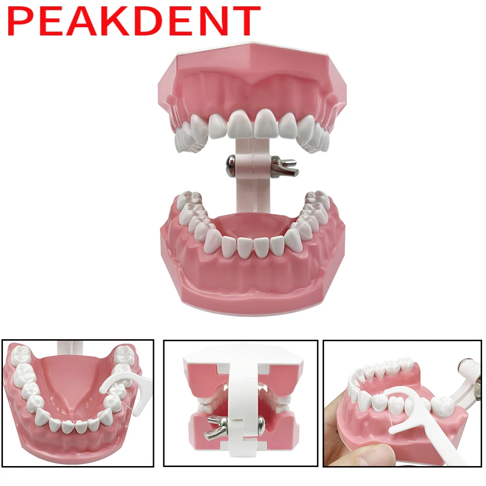 Dental Implant Education Model
