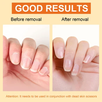 15ml Cuticle Softener Remover Cream For Hand And Foot Nail Care Moisturizing , For Cuticle Dead Skin,Dry Manicures,Brittle Nail 2