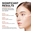 Vitamin C Face Serum Hyaluronic Acid Dark Spot Remover Whitening Moisturizing Repair Anti-aging Essence Facial Skin Care 6