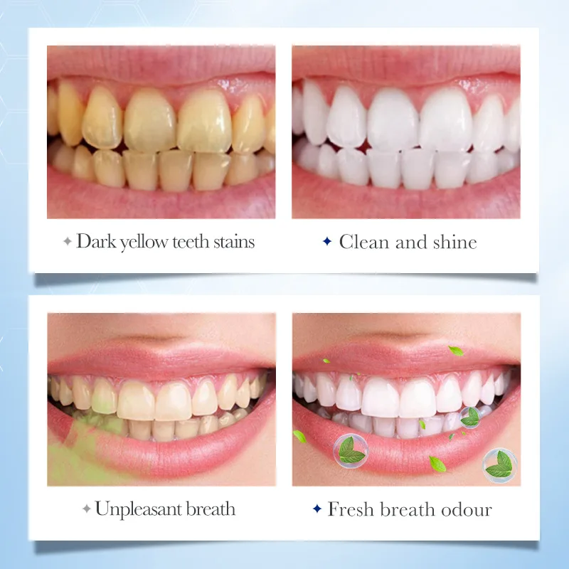 Mint Flavor Whitening Toothpaste Cleaning Teeth Repair Cavities Caries Removal Plaque Yellow Stain Oral Fresh Breath Gum Care