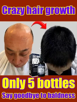 [Really effective good product] Essential oils promote rapid hair growth, strengthen, prolong, nourish and protect hair