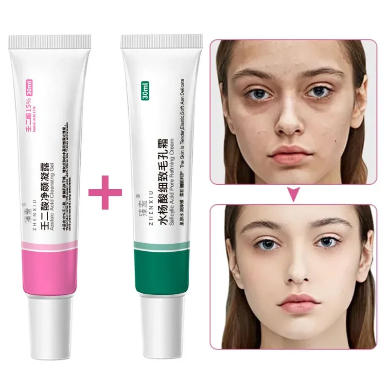 

Face Shrinking Pores Gel Moisturizes Improves Dry Skin Whitening Serum Remove Blackhead Acne Cream Closed Acne Oil Control Cream