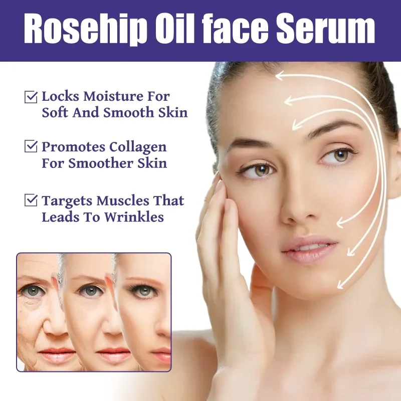 

Sdatter Rosehip oil facial essence remove Dark spots fade fine lines anti wrinkle aging firming whitening moisturizing skin car