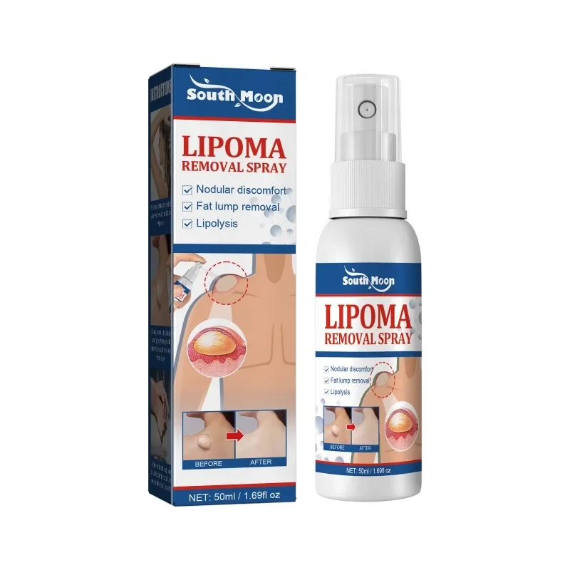 Lipoma Removal Medicines Spray Fibroma Cellulite Remover Apply To Subcutaneous Lumps Fat Mass Treatment Skin Swelling Cream cream lumps remover