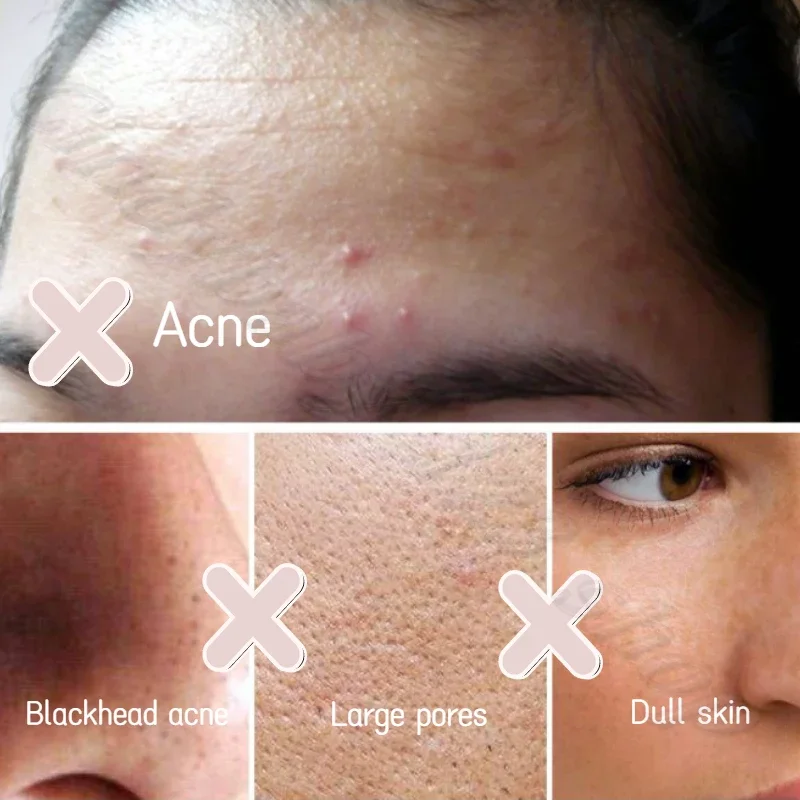 Himalayan natural Centella asiais refined powder salt refreshing facial cleanser deep cleansing blackhead cleanser 125ml 4