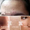Himalayan natural Centella asiais refined powder salt refreshing facial cleanser deep cleansing blackhead cleanser 125ml 4