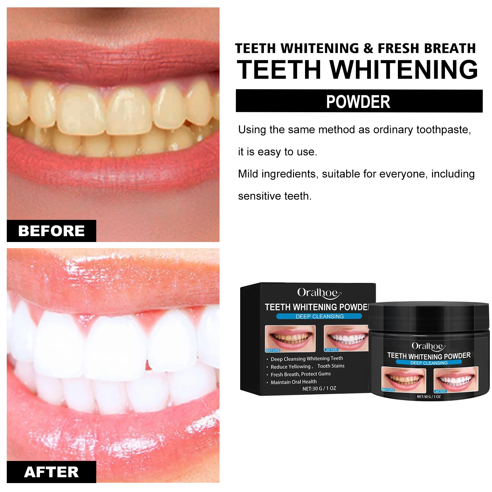 Activated Charcoal Teeth Whitening Powder - Tartar Cleaning, Yellow Stain Reduction, Smokers' Teeth Whitening & Oral Care