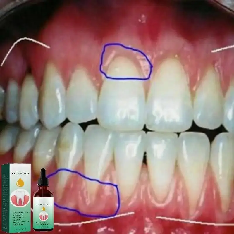 

30ml Gingival Quickly Repair Of Cavities Teeth Clean Whiten Remove Yellow Plaque Stains Relieve Gums Pain Decay Toothache