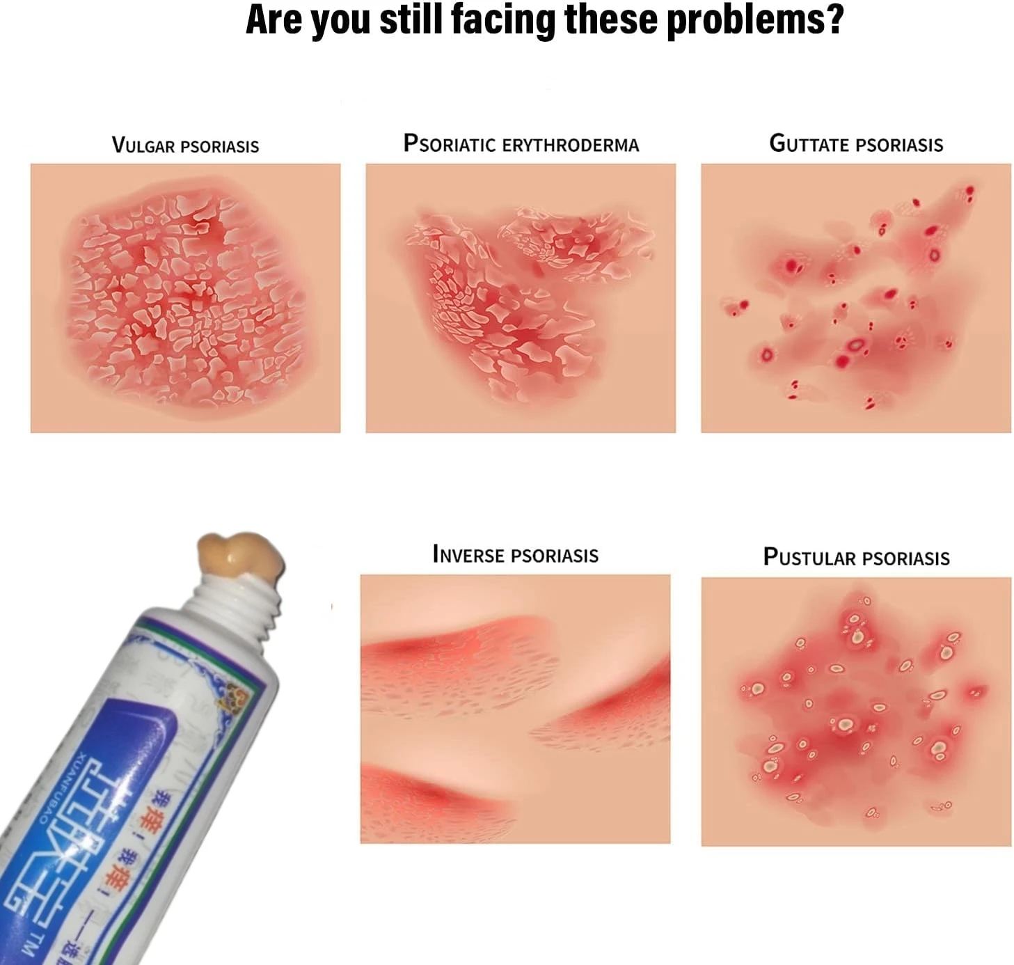 Natural Chinese Herbal Eczema Psoriasis Cream Dermatitis And Eczema Pruritus Psoriasis Ointment Healthy Skin Care