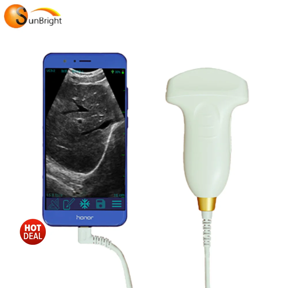 

CE SUN-P1 USB Wire Smartphone Ultrasound Convex Transducer Mobile Phone Scanner
