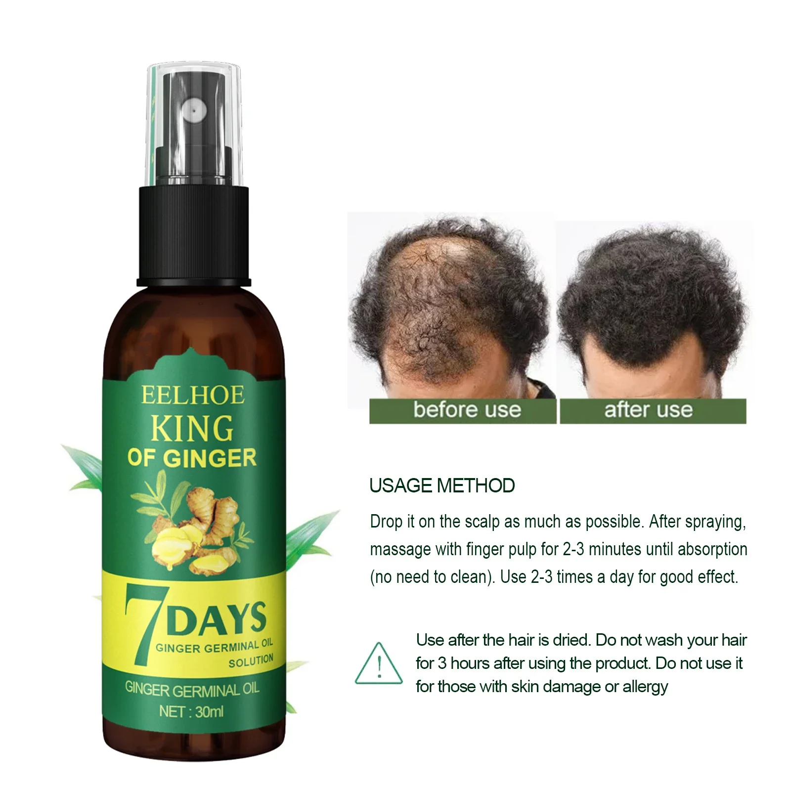 Ginger Care Hair Spray Nourish Hair Roots Massag Scalp RepairHair Growth Essence Quality Control Oil Care Solution