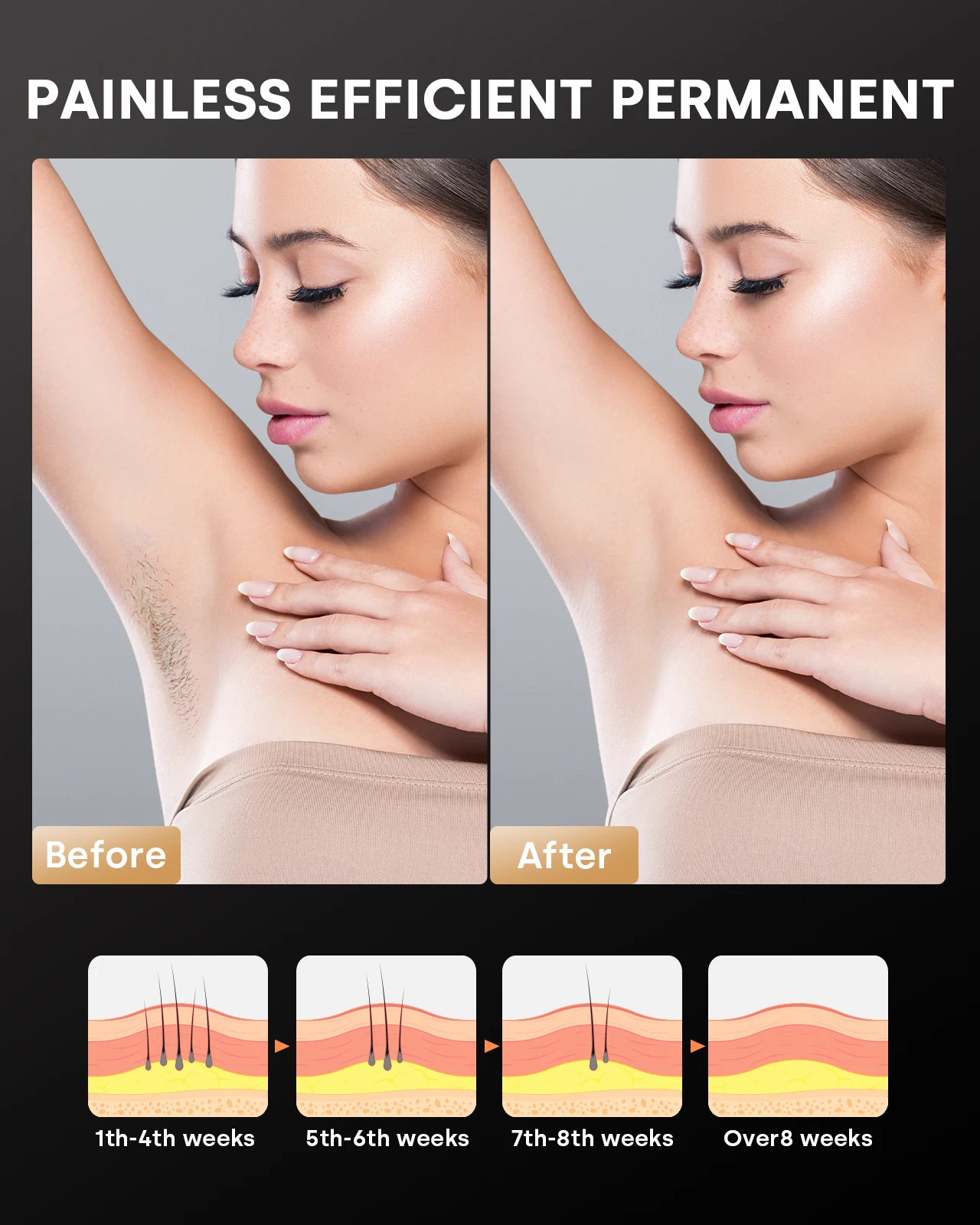 Laser Hair Removal IPL Device 999,900 Flashes Permanent Epilator for Facial Legs Arms Bikini Line for Women Men Home Treament 2