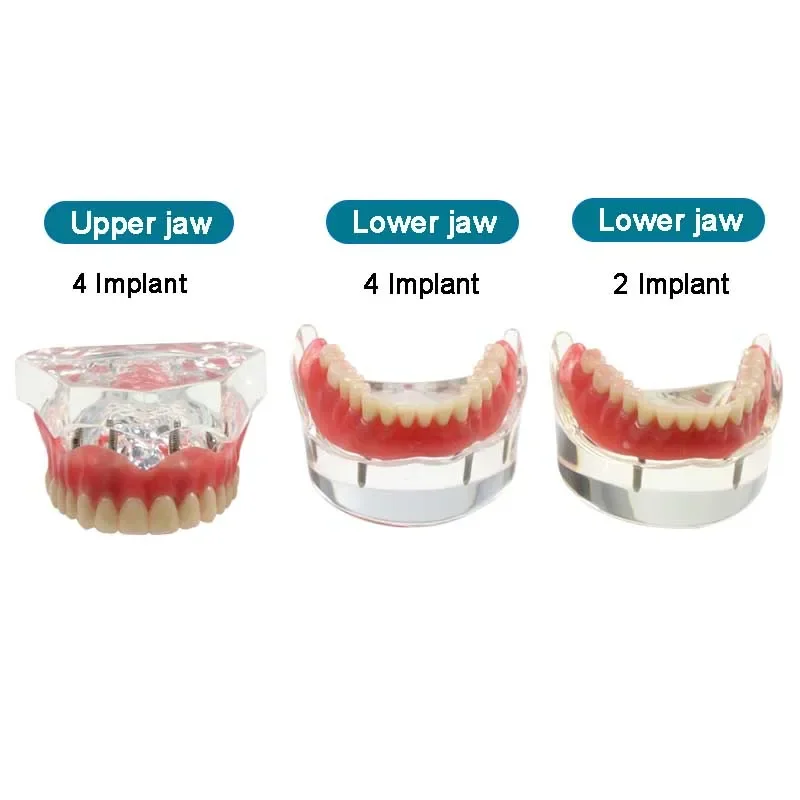YOUYA DENTAL TM-022 Strumenti di studio didattico Typodont Modello anatomico articolato con 32 denti rimovibili