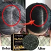 Magic White Hair to Black Shampoo Dye Soap Natural Color Soap Restore Gray Beard Cover Gray Hair Dye Hair Fixing Shampoo Bar 3