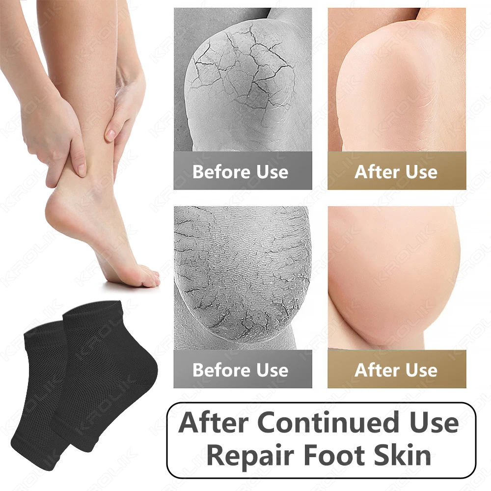 1pair Silicone Moisturizing Gel Heel Socks Reusable Anti Cracked Chapped Foot Smooth Skin Care Exfoliating Foot Protector Tools