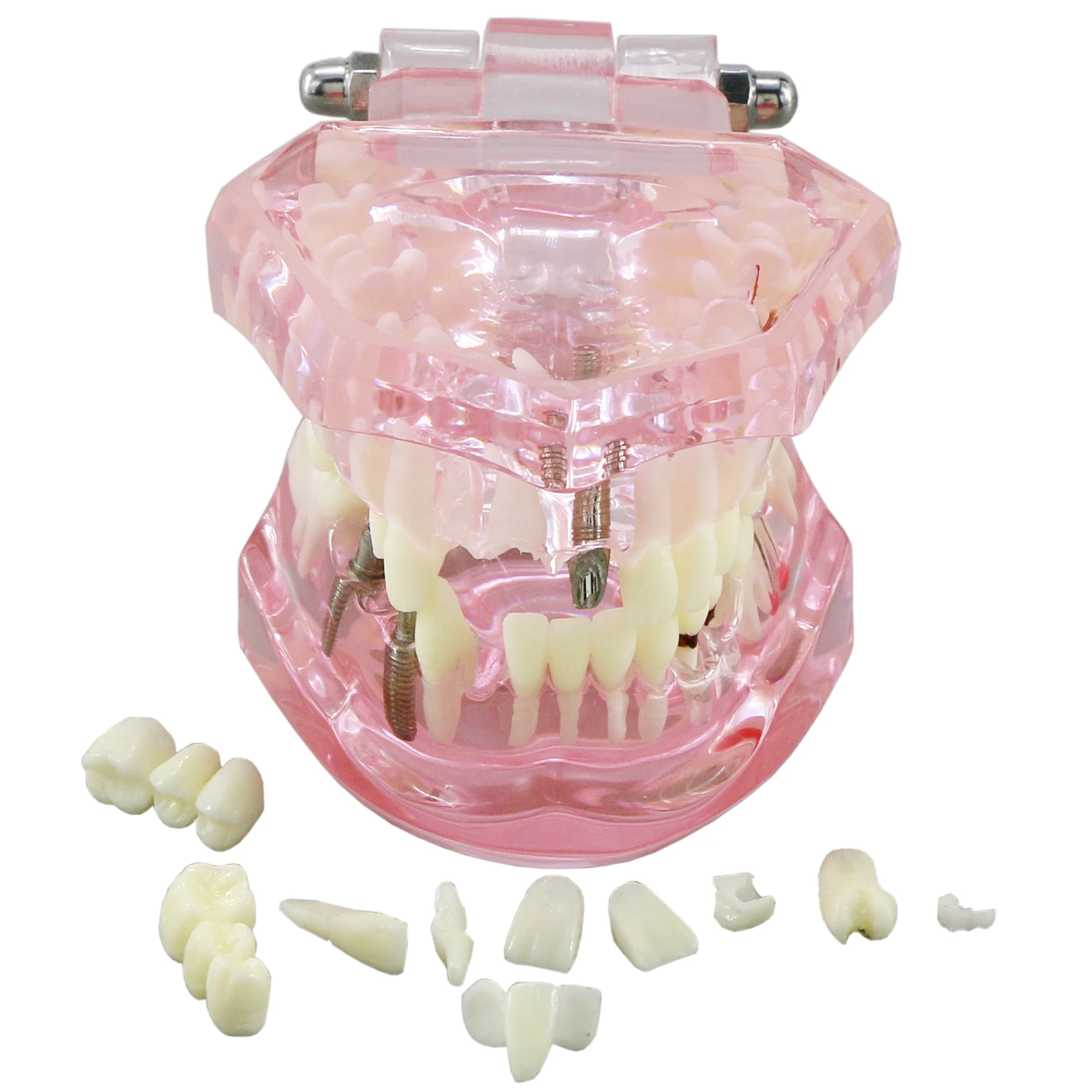 

Dental Implant Restoration Typodont Teeth Tooth Model M2001 Pink Color Demo Oral Pathology Bridge Teach Study