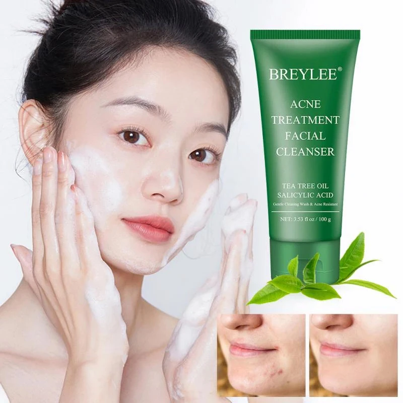 

Women Facial Acne Treatment Cleanser Remove Blackhead Cleaner Shrink Pore Oil Control Cleansing Wash Mask Face Skin Care