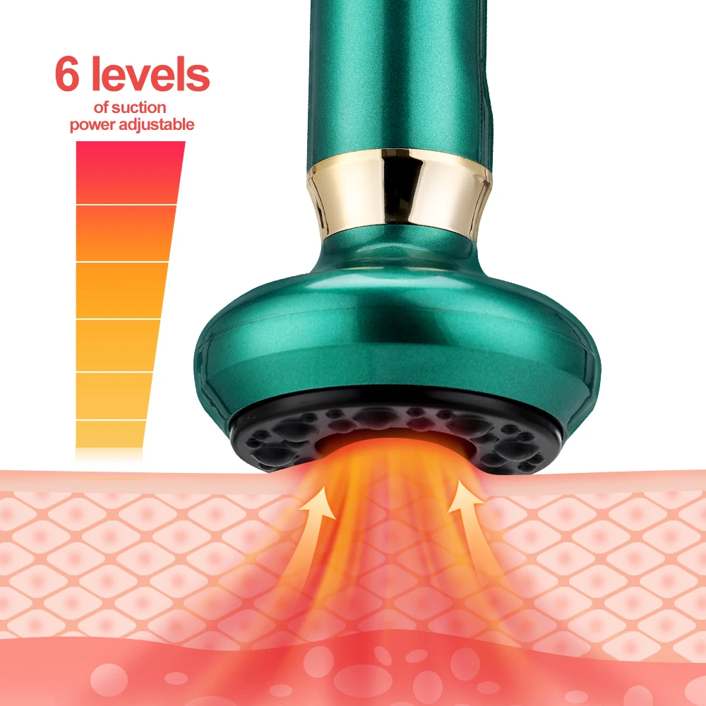 Electric Cupping Massager Vacuum Suction Cup GuaSha Anti Cellulite Beauty Health Scraping Infrared Heat Body Slimming Massage 3