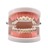 Dental Orthodontic Treatment Teeth Model With Bracket Arch Wire Buccal Tube Ligature Ties Dentist Lab Tooth Model Teaching Tools 1