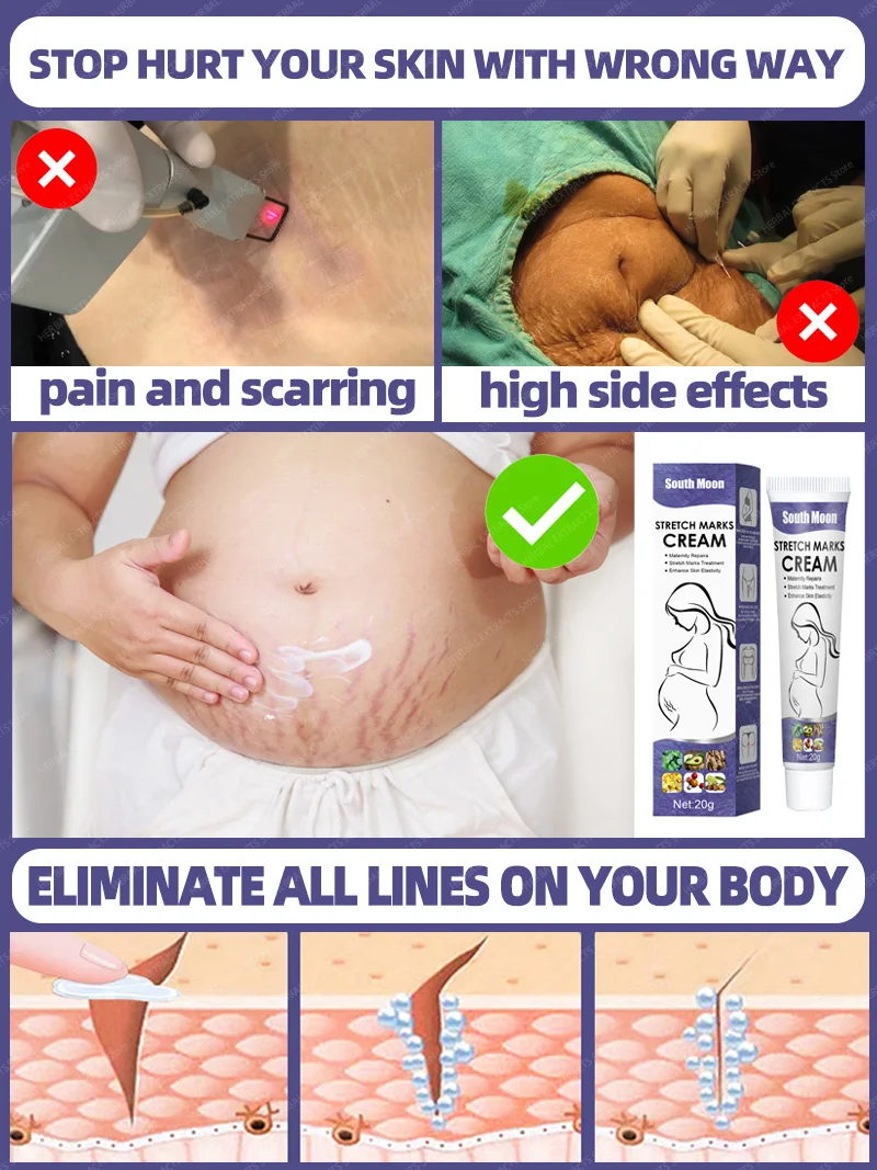 Рисунок 4 - Крем для перманентного Удаления растяжек