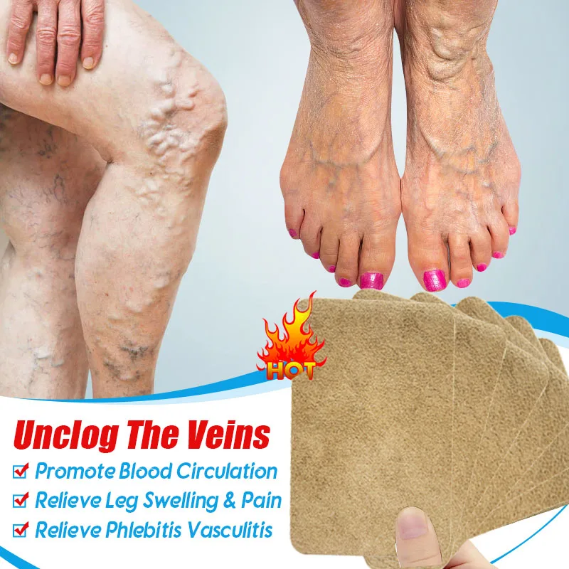 Varicose vein patch for treatment of varicose muscle vasculitis alleviating muscle swelling pain 6pcs=1bag