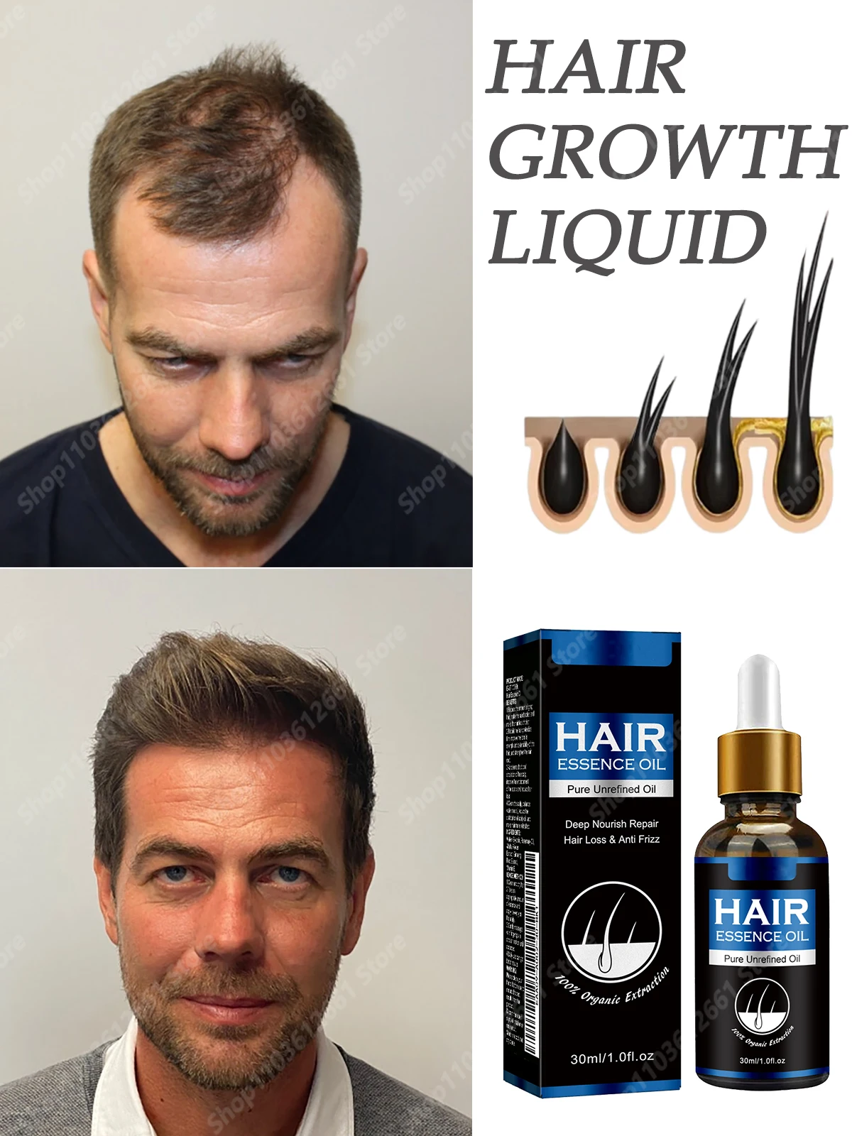 Anti-Hair Loss Treatment Rapid hair growth Liquid Hair Hydrating Growth Nutrient Solution effective hair growth product