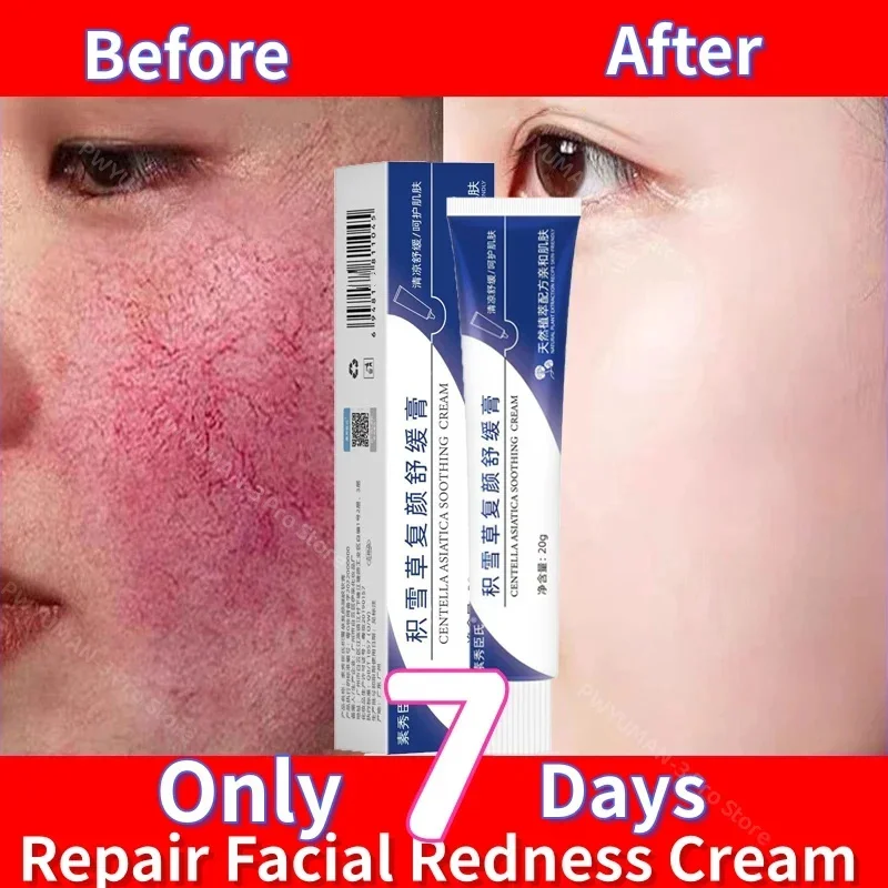 Instant Facial Redness Repair Cream Rosacea Red Blood Acne Treatment Soothing Improve Sensitive Moisturizing Brighten Skin Care