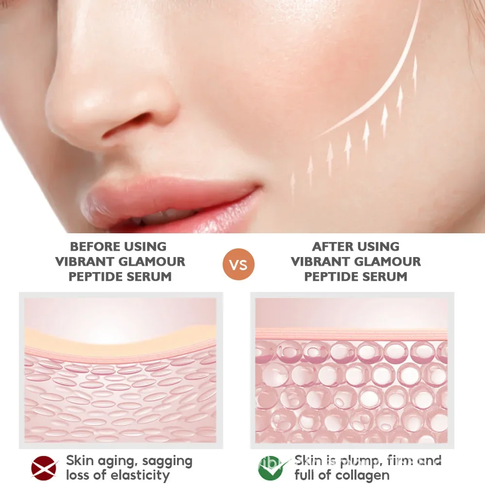 Peeling Serum Salicylic Acid Face Essence Shrink Pores Acne Treatment Removal Blackhead Melasma Whitening Facial Skin Care