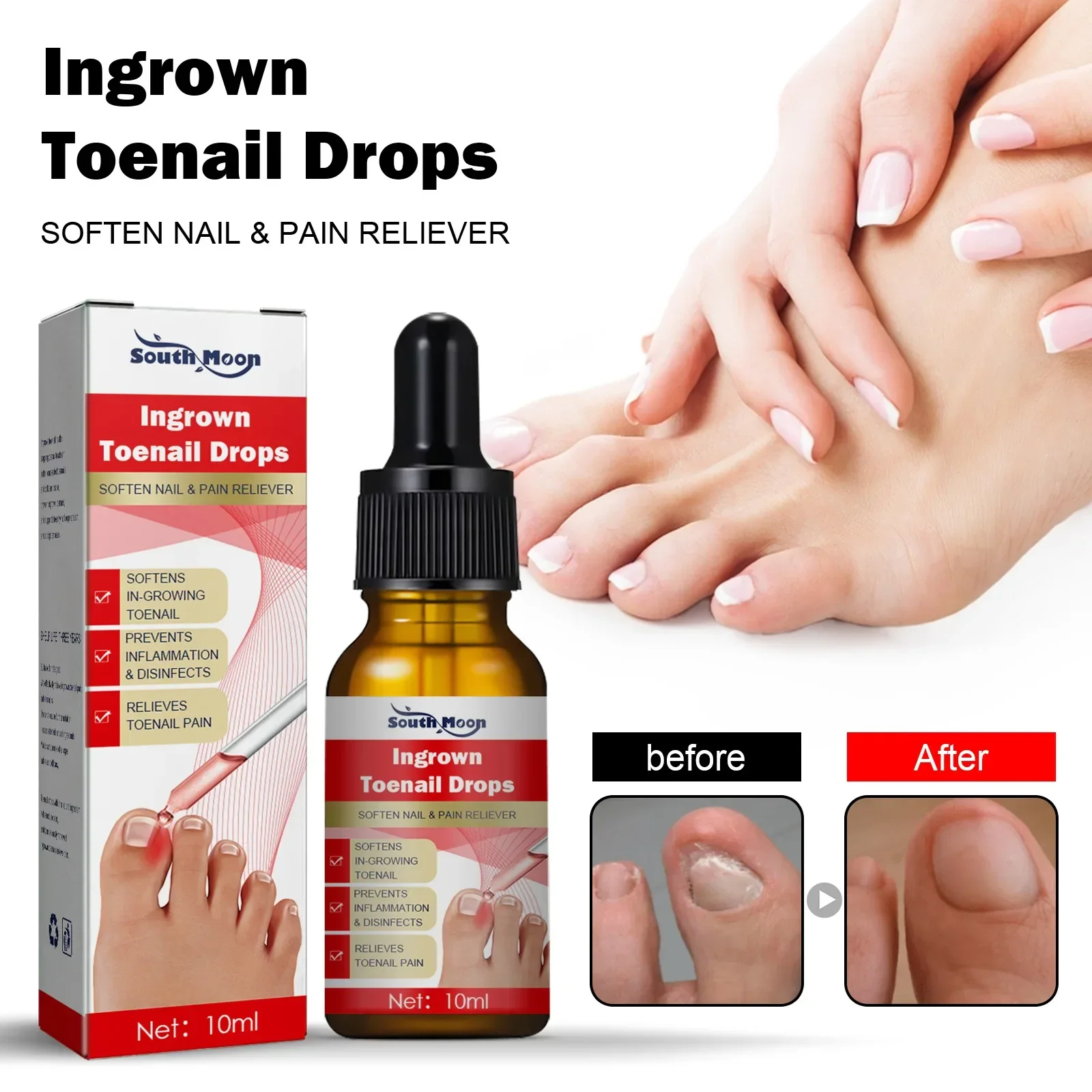 Nail Treatment Essence for Ingrown Toenail Fungus Repair