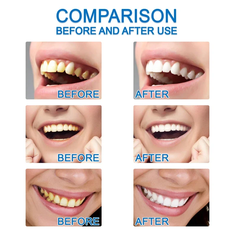 Teeth Whitening Essence Remove Plaque Stains Serum Oral Hygiene Against Dental Caries teeth whitening essence teeth whitening product teeth health product